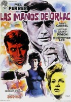 the-hands-of-orlac00.jpg